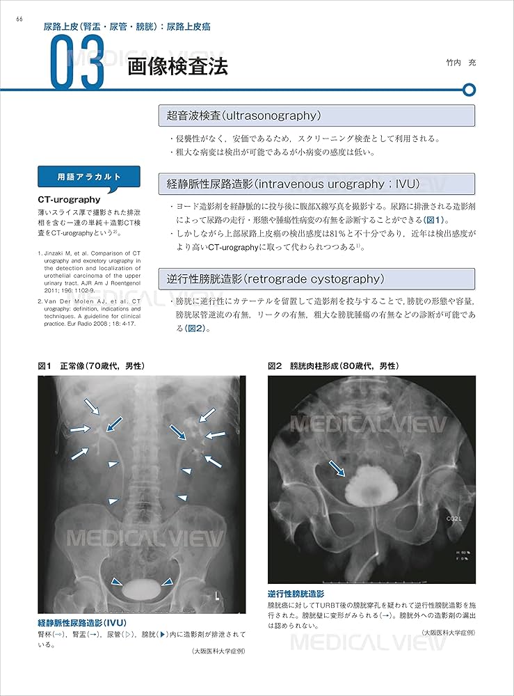 Urology View 6ー5 特集:知っておきたい泌尿器科領域における染色体異常，遺伝性疾 Urology View 6ー5 特集:知っておきたい泌尿器科領域における